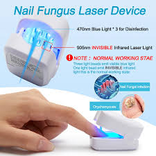 NailNova™ | Lazer Destekli Akıllı Tırnak Bakım Cihazı